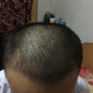 发际线分享社区