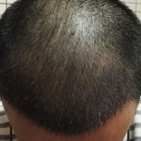 發(fā)際線用戶圖片