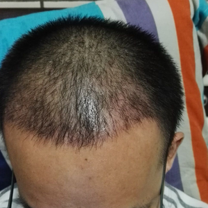 发际线分享社区