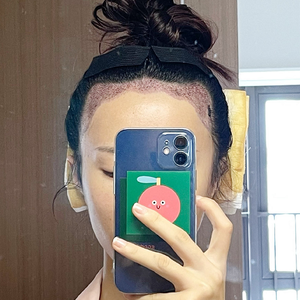 发际线分享社区