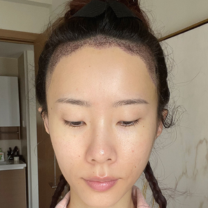 发际线分享社区