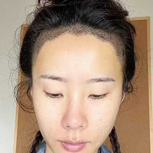 发际线分享社区
