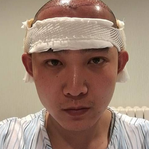 发际线分享社区