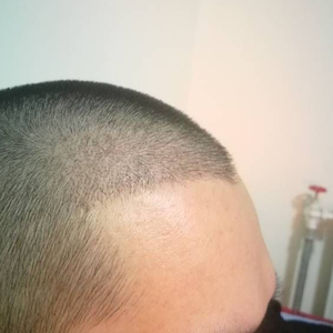 发际线分享社区