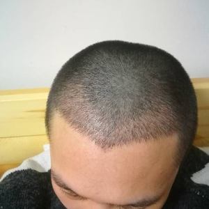 发际线分享社区