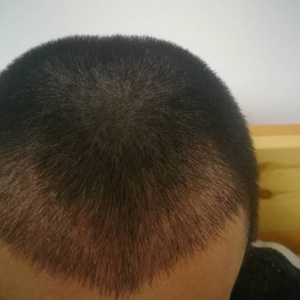 发际线分享社区