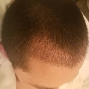 发际线分享社区