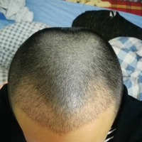 發(fā)際線用戶圖片