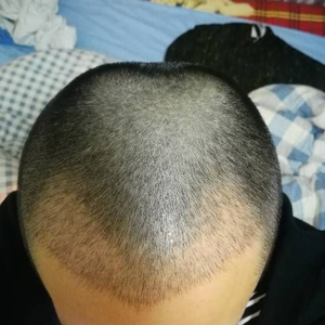发际线分享社区