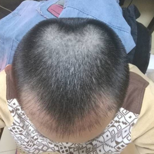 发际线分享社区