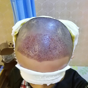 发际线分享社区