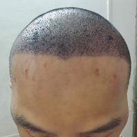 發(fā)際線用戶圖片