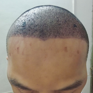 发际线分享社区