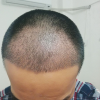 發(fā)際線用戶圖片