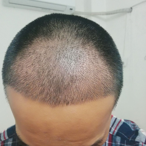 发际线分享社区
