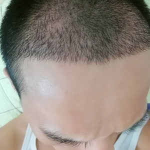 发际线分享社区