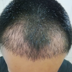 发际线分享社区