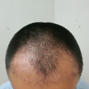 发际线分享社区