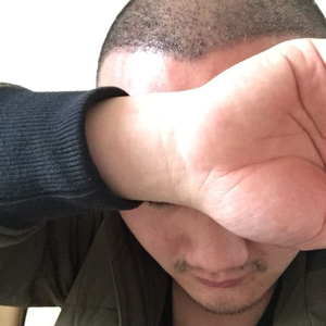 发际线分享社区