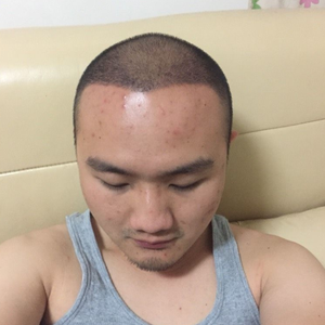 发际线分享社区
