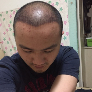发际线分享社区