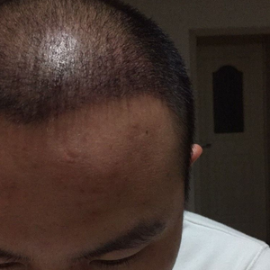 发际线分享社区