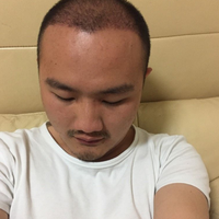 發(fā)際線用戶圖片