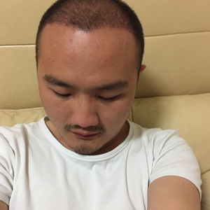 发际线分享社区