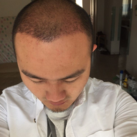 發(fā)際線用戶圖片