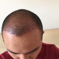 發(fā)際線用戶圖片