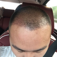 發(fā)際線用戶圖片