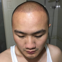 發(fā)際線用戶圖片