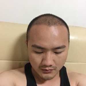 发际线分享社区