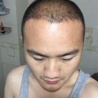 發(fā)際線用戶圖片