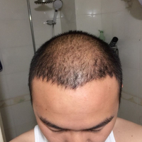 發(fā)際線用戶圖片
