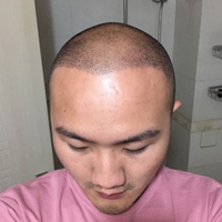 發(fā)際線用戶圖片