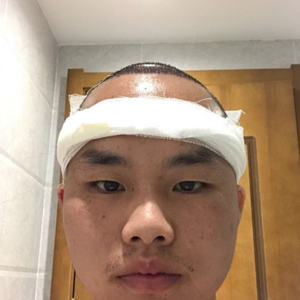 发际线分享社区