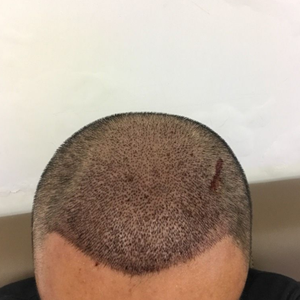 发际线分享社区