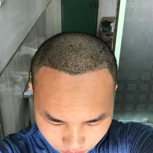 发际线分享社区