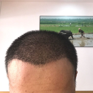 发际线分享社区