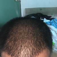 發(fā)際線用戶(hù)圖片