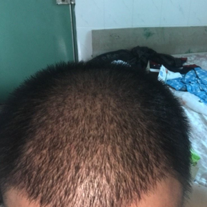 发际线分享社区