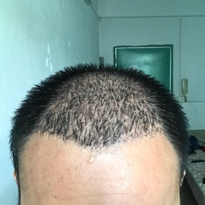 发际线分享社区