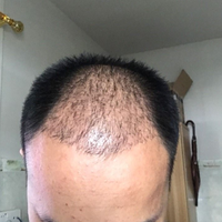 發(fā)際線用戶(hù)圖片