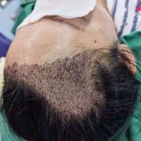 發(fā)際線用戶圖片
