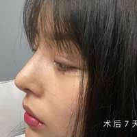 發(fā)際線用戶圖片