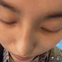 發(fā)際線用戶圖片
