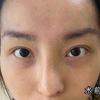 發(fā)際線用戶圖片