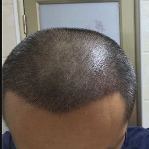 发际线分享社区