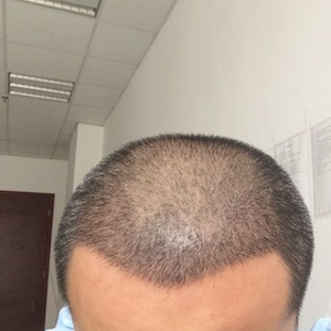 发际线分享社区
